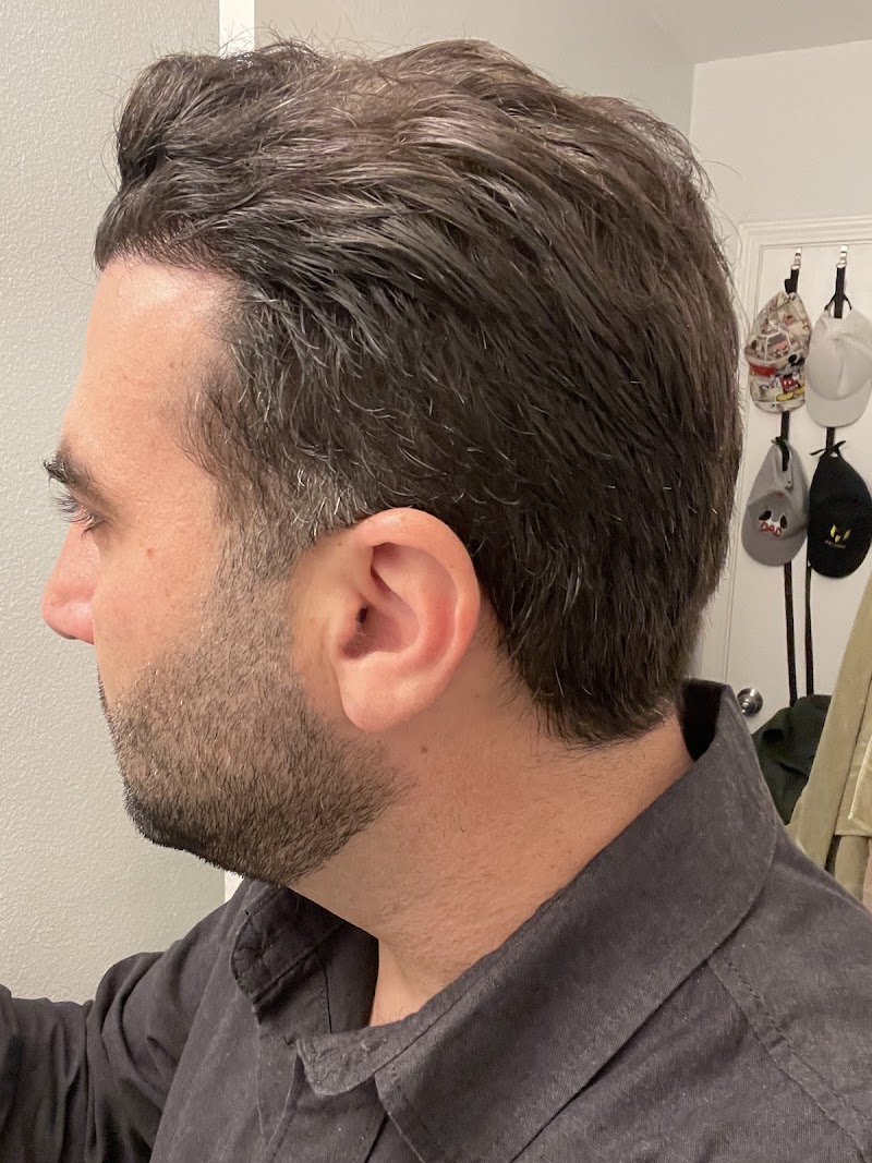 S3 Hair Transplant Clinic, Houston, Texas