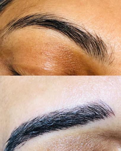 Skinrevite laser clinic