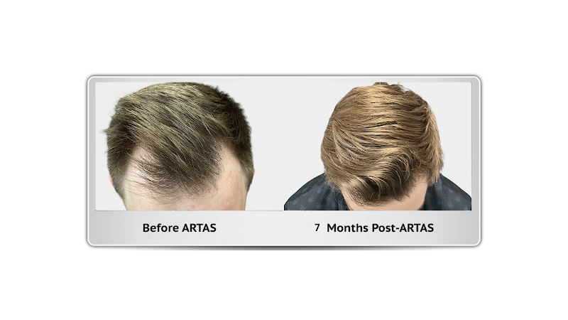HAIRBOT MD, Houston, Texas