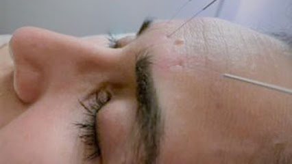 Dharma Reiki & Acupuncture